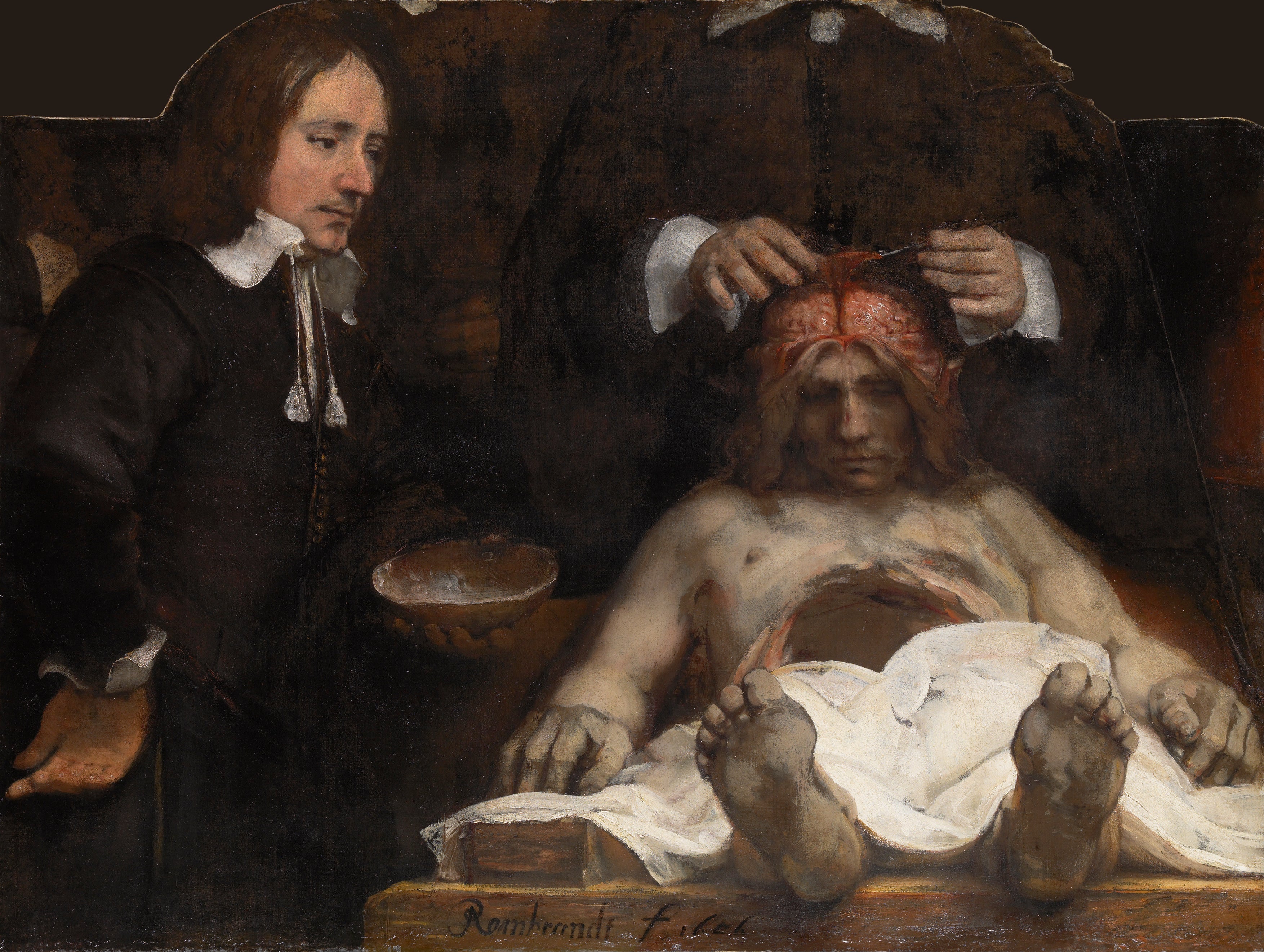 Reproduction du tableau « La Leçon d'anatomie du Docteur Joan Deyman - Rembrandt » par Alpha Reproduction en peinture à l’huile